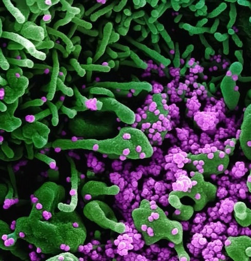 microbioma